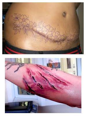 tatuajes para cubrir cicatrices imagenes