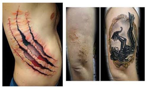 Tatuajes para cicatrices