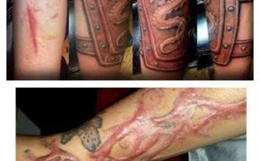 tatuajes para cubrir cicatrices fotos